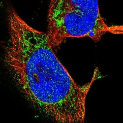 OGDH Antibody, Novus Biologicals 25 &mu;L; Unlabeled:Antibodies, Polyclonal